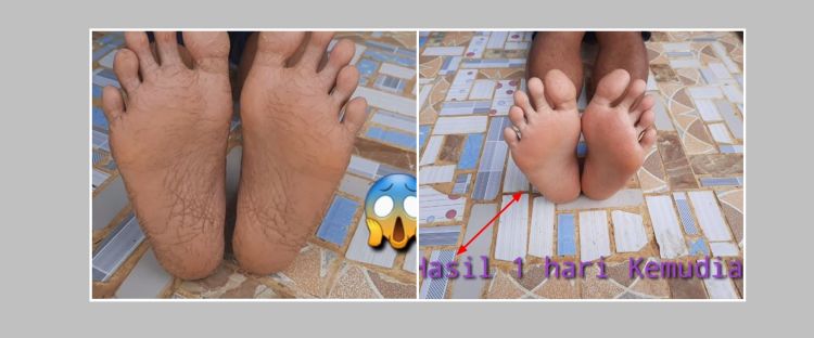 Krim Tangan Getah Karet Merah Papua: Rahasia Kulit Sehat Alami dari Jantung Hutan Tropis